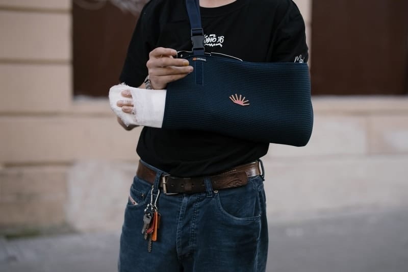 Man-With-A-Cast-On-Injured-Left-Hand